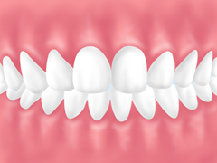 歯並びの管理